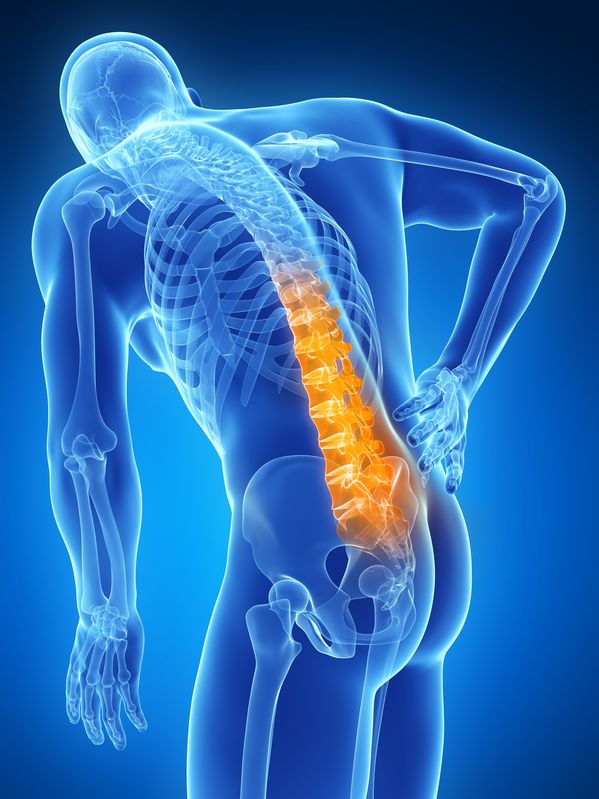 Arthrose